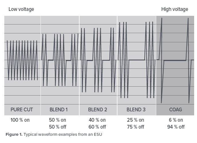 Typical waveform examples from an ESU