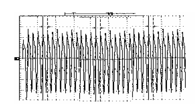 Graph of a pure cut waveform from an ESU