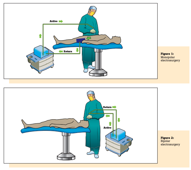 Monopolar Electrosurgery Figure 1 & 2