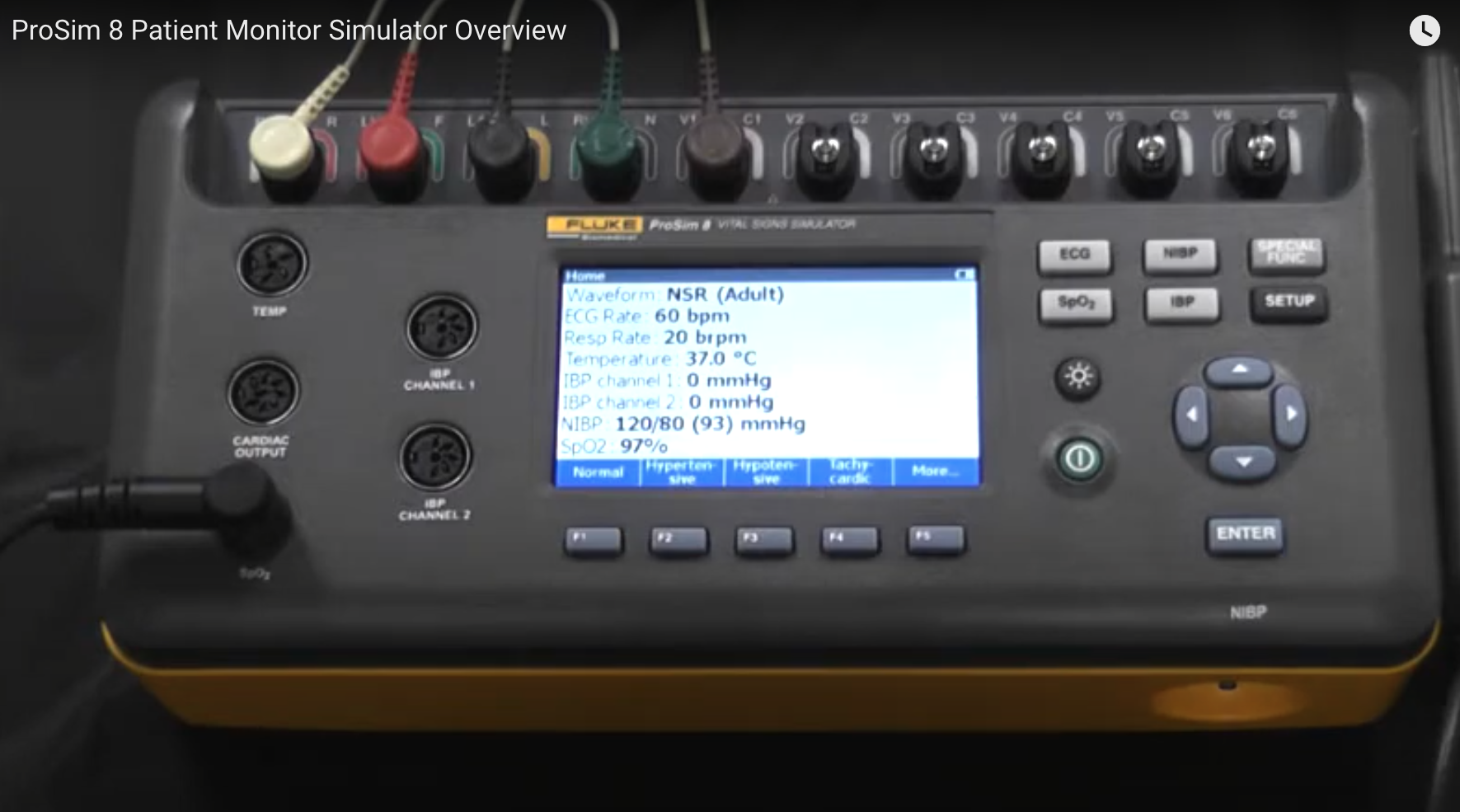 ProSim 8 Patient Monitor Simulator Overview