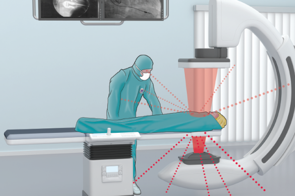 Scattered radiation and dose exposure