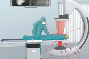 Scattered radiation and dose exposure